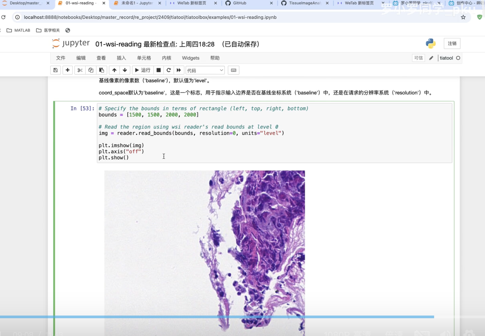 病理AI入门课程1:配置环境&读取WSI